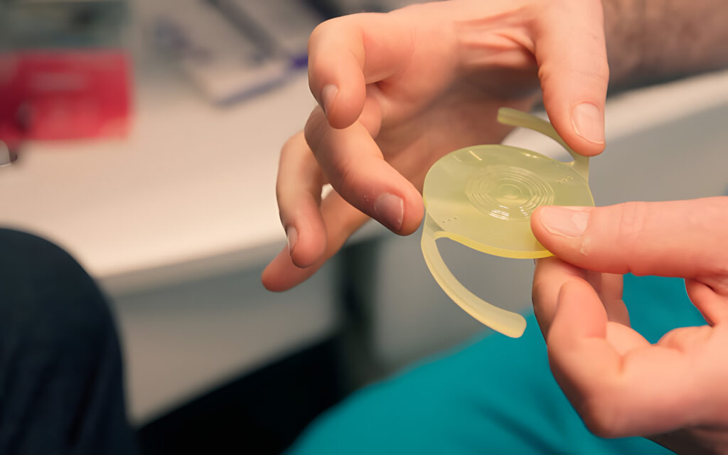 Modello lente intraoculare interventi cataratta - a Milano