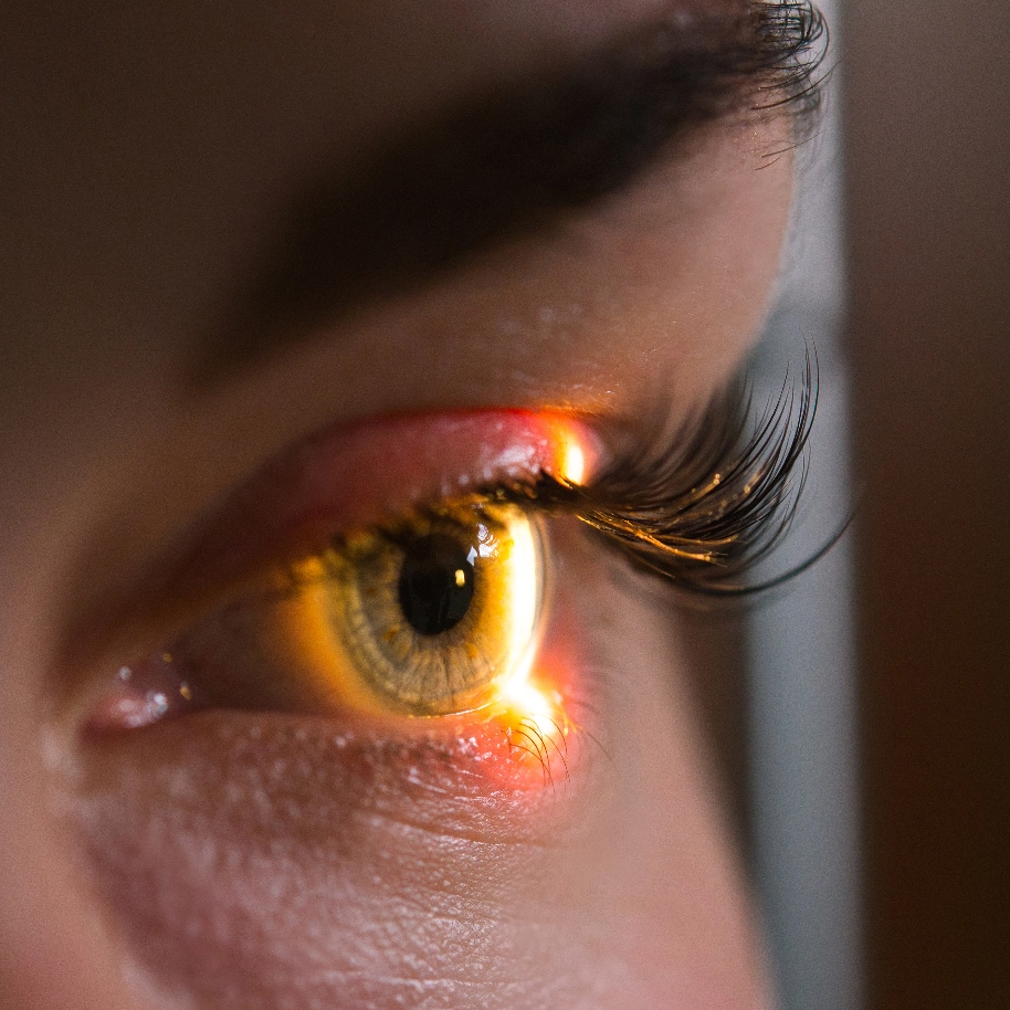 Occhio in primo piano senza lenti, chirurgia refrattiva a Milano per vista nitida