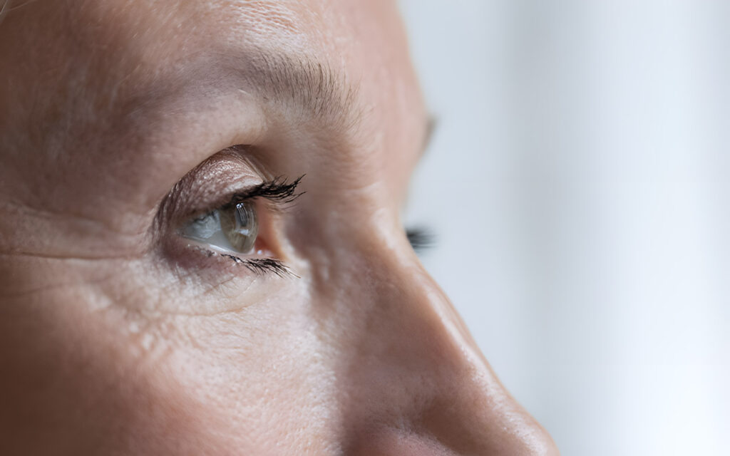 Occhi signora in primo piano serena dopo intervento cataratta a Milano